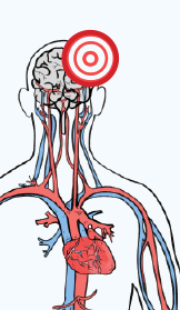 Color drawing of the cardiovascular system, chest up. There is a red bullseye on the upper left of the brain.