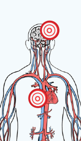Color drawing of the cardiovascular system, midsection up. There is a red bullseye on both the brain and heart.  